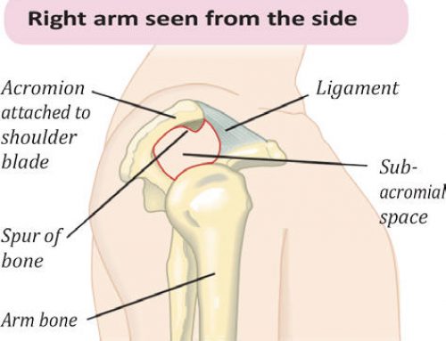 The Shoulder-Rotator Cuff and Sub-acromial impingement